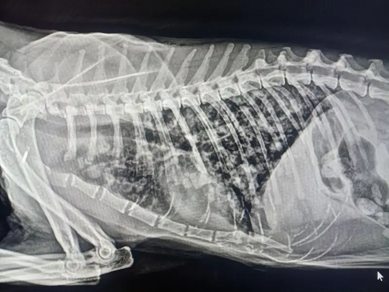foto rx metastasis copia